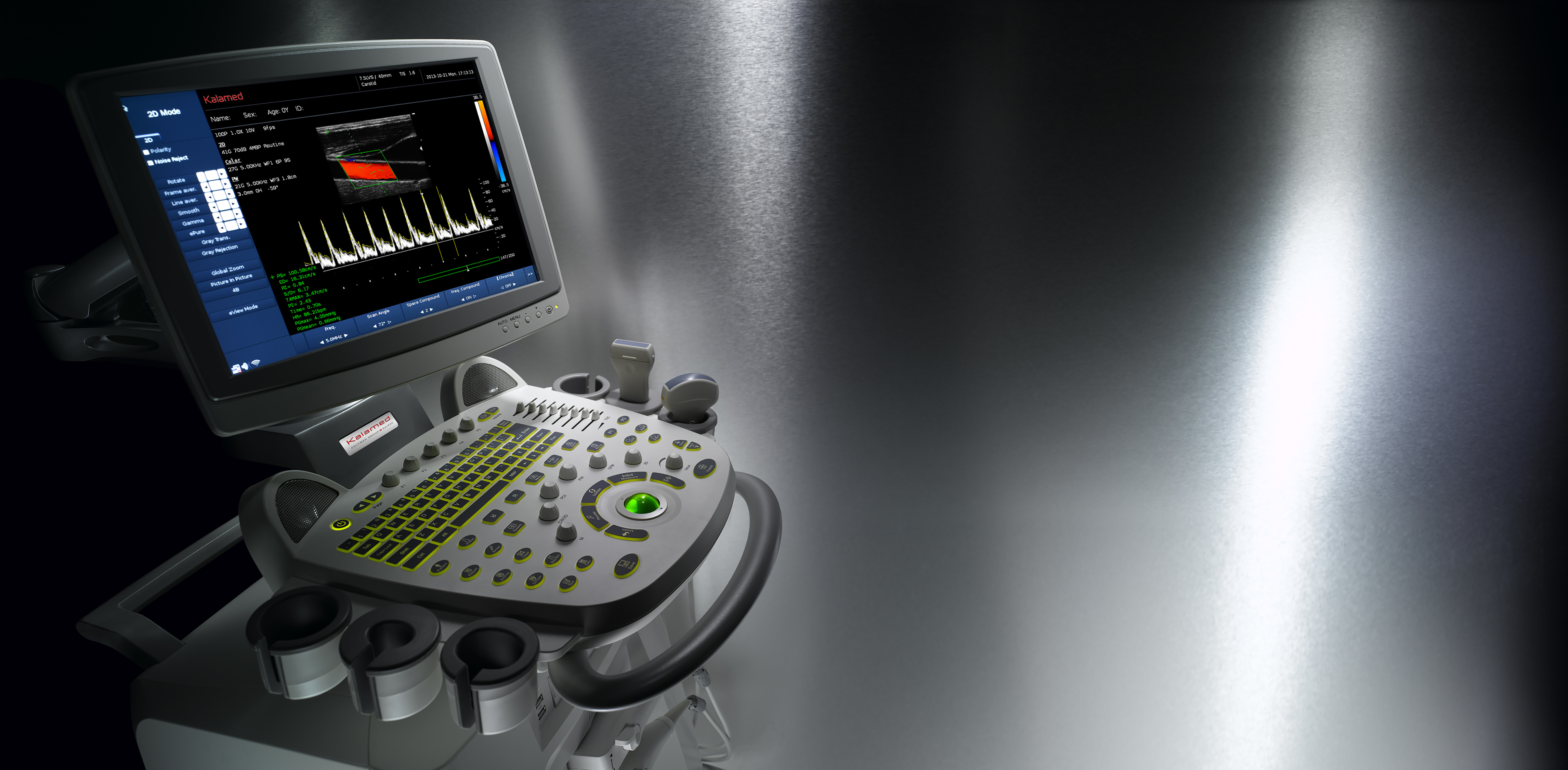 Digital Ultrasound System